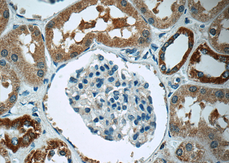 Immunohistochemistry of paraffin-embedded human kidney tissue slide using Catalog No:114433(RAB34 Antibody) at dilution of 1:50 (under 40x lens)