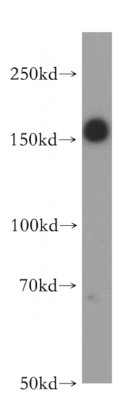 A549 cells were subjected to SDS PAGE followed by western blot with Catalog No:111933(IRS1 antibody) at dilution of 1:400