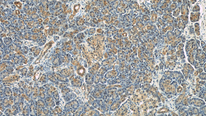 Immunohistochemical of paraffin-embedded human pancreas using Catalog No:114559(RBP1 antibody) at dilution of 1:50 (under 10x lens)