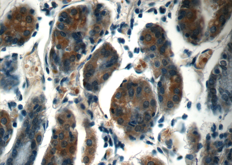 Immunohistochemistry of paraffin-embedded human stomach tissue slide using Catalog No:116938(ZDHHC13 Antibody) at dilution of 1:50 (under 40x lens)