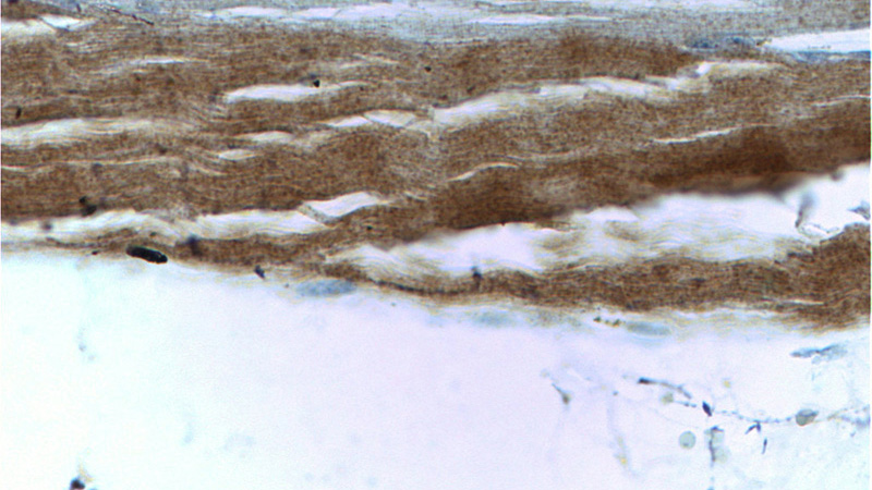 Immunohistochemistry of paraffin-embedded human skeletal muscle tissue slide using Catalog No:107318(Myosin 2a Antibody) at dilution of 1:100 (under 40x lens)