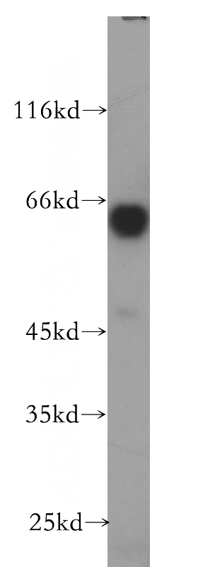 HepG2 cells were subjected to SDS PAGE followed by western blot with Catalog No:114283(PRUNE antibody) at dilution of 1:600