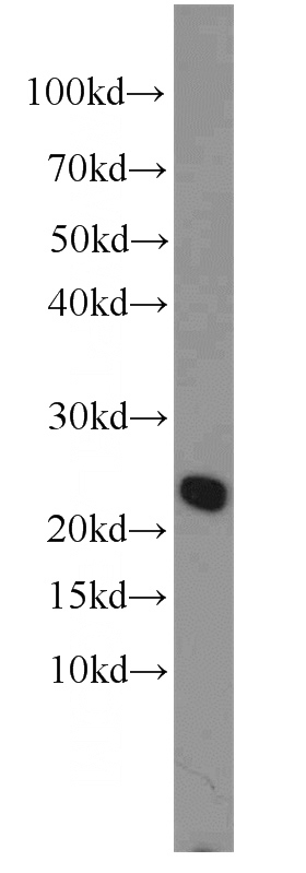 HeLa cells were subjected to SDS PAGE followed by western blot with Catalog No:114636(RFXAP antibody) at dilution of 1:1000