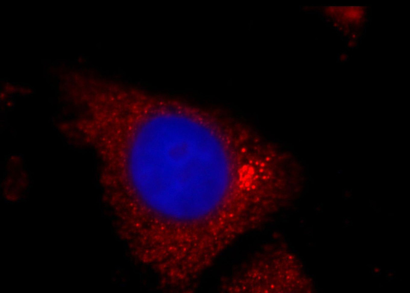 Immunofluorescent analysis of HepG2 cells, using TPM2 antibody Catalog No:116267 at 1:25 dilution and Rhodamine-labeled goat anti-rabbit IgG (red).Blue pseudocolor = DAPI (fluorescent DNA dye).