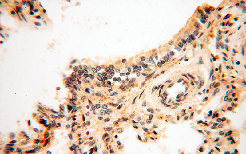 Immunohistochemical of paraffin-embedded human lung using Catalog No:110872(GAS6 antibody) at dilution of 1:50 (under 40x lens)