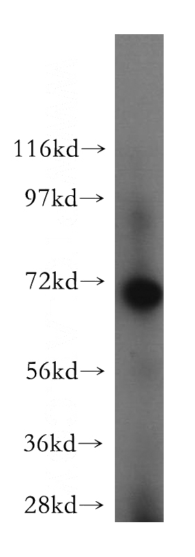 MCF7 cells were subjected to SDS PAGE followed by western blot with Catalog No:117226(BRCC3 antibody) at dilution of 1:300