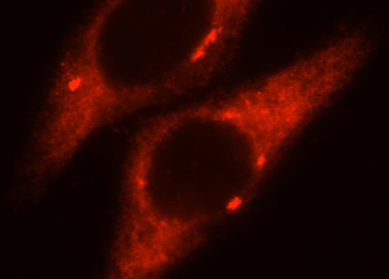 Immunofluorescent analysis of HepG2 cells, using SEC61A1 antibody Catalog No:115085 at 1:25 dilution and Rhodamine-labeled goat anti-rabbit IgG (red).