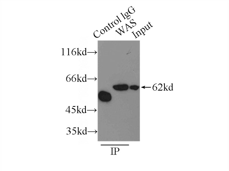 IP Result of anti-WAS (IP:Catalog No:116844, 3ug; Detection:Catalog No:116844 1:500) with Raji cells lysate 3500ug.