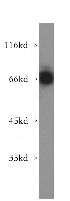 Jurkat cells were subjected to SDS PAGE followed by western blot with Catalog No:112661(MITF antibody) at dilution of 1:400