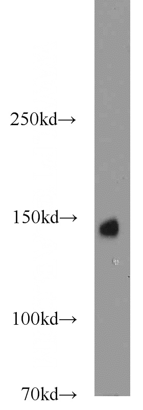 mouse eye tissue were subjected to SDS PAGE followed by western blot with Catalog No:114561(RBP3 antibody) at dilution of 1:600