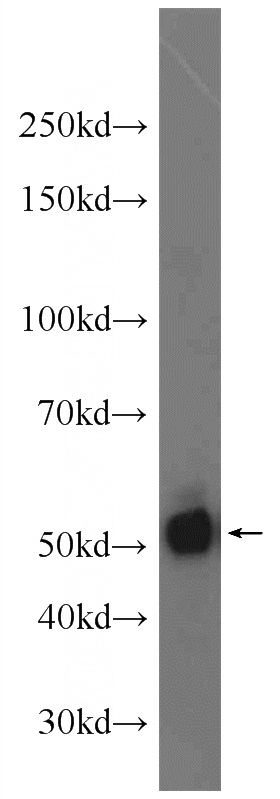 HeLa cells were subjected to SDS PAGE followed by western blot with Catalog No:112082(KLF5 Antibody) at dilution of 1:1000