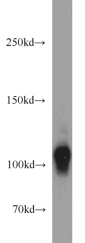 mouse brain tissue were subjected to SDS PAGE followed by western blot with Catalog No:111284(HCN1 antibody) at dilution of 1:500