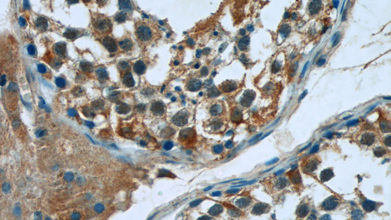 Immunohistochemistry of paraffin-embedded human testis tissue slide using Catalog No:110668(FJX1 Antibody) at dilution of 1:50 (under 40x lens)