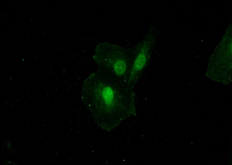 Immunofluorescent analysis of A549 cells using Catalog No:110885(GATAD2B Antibody) at dilution of 1:50 and Alexa Fluor 488-congugated AffiniPure Goat Anti-Rabbit IgG(H+L)