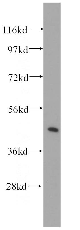 human kidney tissue were subjected to SDS PAGE followed by western blot with Catalog No:115793(STX16 antibody) at dilution of 1:500