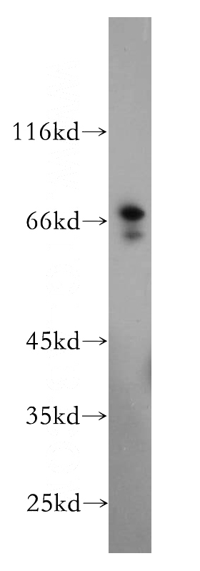 HepG2 cells were subjected to SDS PAGE followed by western blot with Catalog No:112382(MAGEA6 antibody) at dilution of 1:500