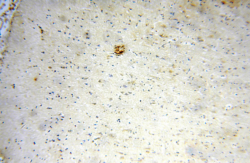 Immunohistochemical of paraffin-embedded human brain using Catalog No:112520(METTL5 antibody) at dilution of 1:100 (under 10x lens)