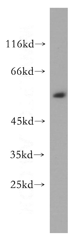 BxPC-3 cells were subjected to SDS PAGE followed by western blot with Catalog No:112652(MEMO1 antibody) at dilution of 1:300