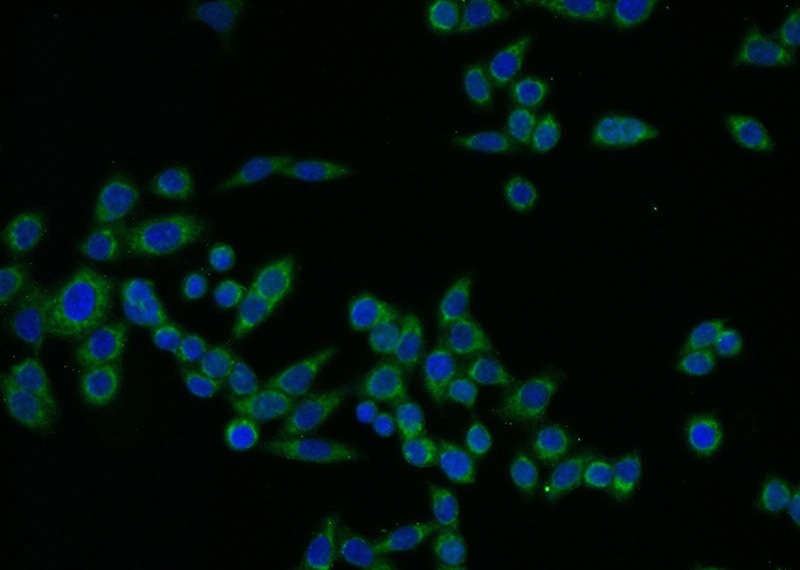 Immunofluorescent analysis of BxPC-3 cells using Catalog No:116139(TIMP1 Antibody) at dilution of 1:25 and Alexa Fluor 488-congugated AffiniPure Goat Anti-Rabbit IgG(H+L)