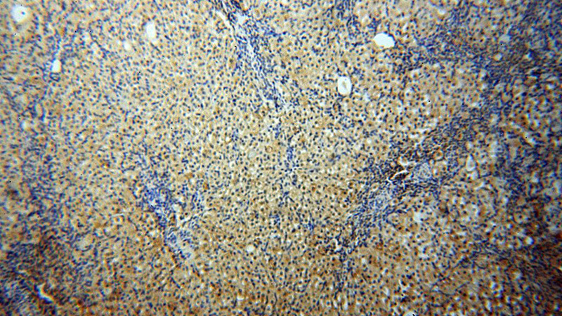 Immunohistochemical of paraffin-embedded human ovary using Catalog No:109420(CNBP antibody) at dilution of 1:50 (under 10x lens)