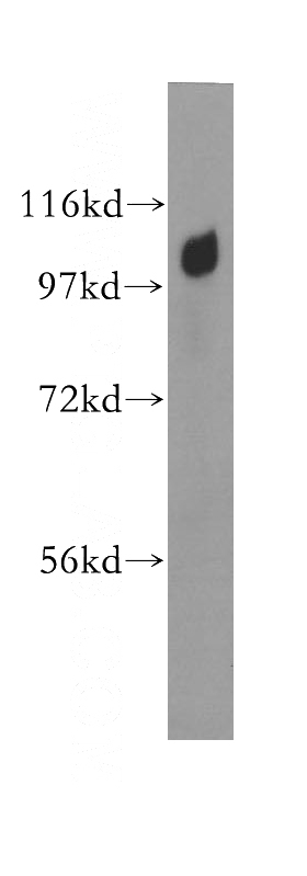 HEK-293 cells were subjected to SDS PAGE followed by western blot with Catalog No:107866(AP2A1 antibody) at dilution of 1:1000