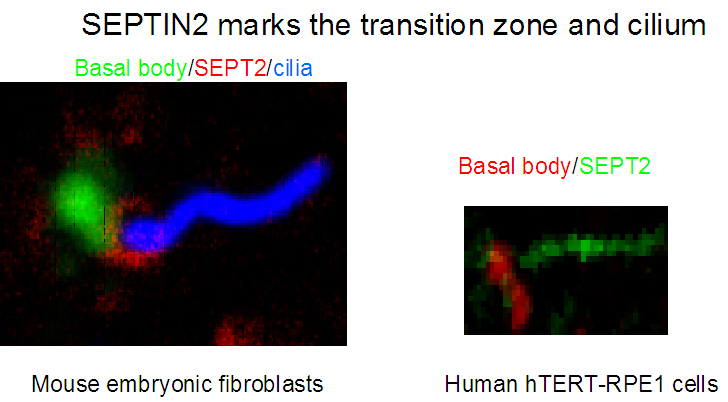 IF result from Dr. Kevin Corbit. SEPT2(Catalog No:115117) marks the transition zone and cilium of Human hTERT-RPE1 cells and Mouse embryonic fibroblasts.