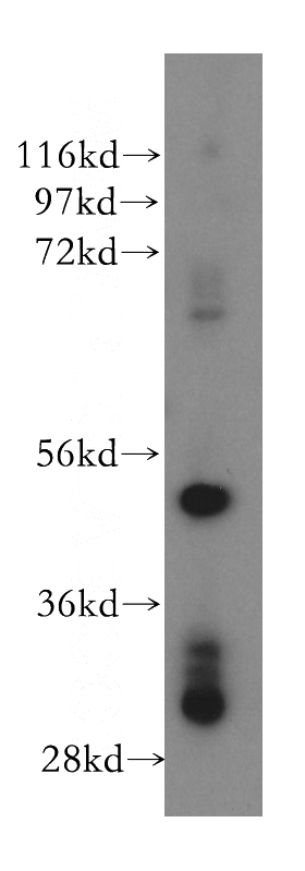 Jurkat cells were subjected to SDS PAGE followed by western blot with Catalog No:114317(PTPN18 antibody) at dilution of 1:500