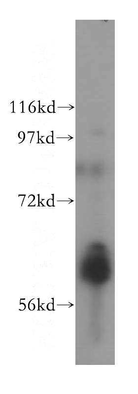 SH-SY5Y cells were subjected to SDS PAGE followed by western blot with Catalog No:107952(AAAS antibody) at dilution of 1:600