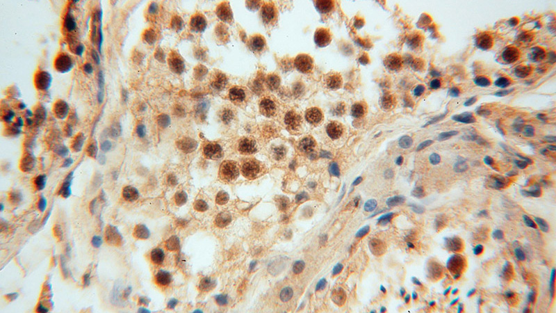 Immunohistochemical of paraffin-embedded human testis using Catalog No:110996(GNB3 antibody) at dilution of 1:50 (under 40x lens)