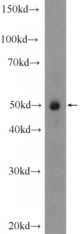 human placenta tissue were subjected to SDS PAGE followed by western blot with Catalog No:113267(NR2F1 Antibody) at dilution of 1:600