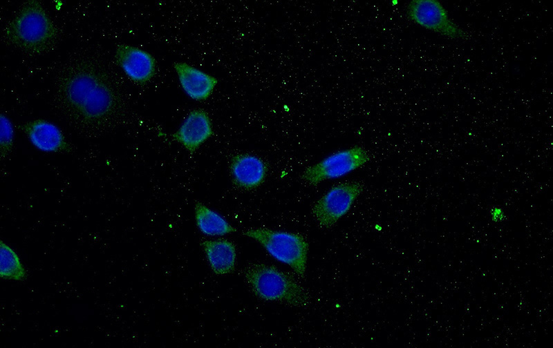 Immunofluorescent analysis of (-20oc Ethanol) fixed HeLa cells using Catalog No:108318(ATP9A Antibody) at dilution of 1:25 and Alexa Fluor 488-congugated AffiniPure Goat Anti-Rabbit IgG(H+L)