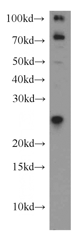 SH-SY5Y cells were subjected to SDS PAGE followed by western blot with Catalog No:112120(KRAS-2A-specific antibody) at dilution of 1:500