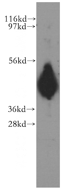 human heart tissue were subjected to SDS PAGE followed by western blot with Catalog No:111918(RP1-21O18.1 antibody) at dilution of 1:1200