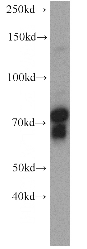 Y79 cells were subjected to SDS PAGE followed by western blot with Catalog No:115503(SORCS1 antibody) at dilution of 1:500
