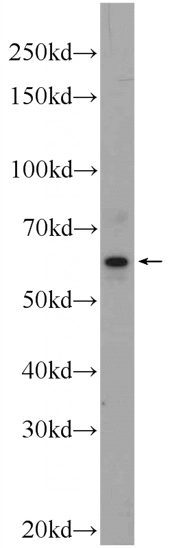 Raji cells were subjected to SDS PAGE followed by western blot with Catalog No:110921(GDAP2 Antibody) at dilution of 1:1000