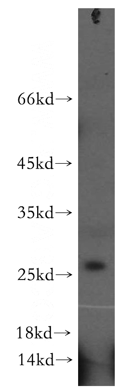 mouse liver tissue were subjected to SDS PAGE followed by western blot with Catalog No:109922(DHRS11 antibody) at dilution of 1:300