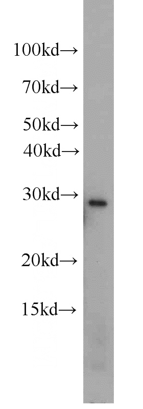 K-562 cells were subjected to SDS PAGE followed by western blot with Catalog No:114378(PSMA8 antibody) at dilution of 1:500