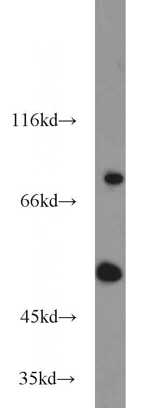 A549 cells were subjected to SDS PAGE followed by western blot with Catalog No:112256(KCNA3 antibody) at dilution of 1:1000