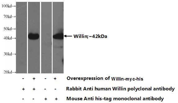 Transfected HEK-293 cells were subjected to SDS PAGE followed by western blot with Catalog No:116827(Willin Antibody) at dilution of 1:1000