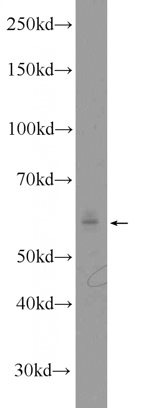 MCF-7 cells were subjected to SDS PAGE followed by western blot with Catalog No:115370(SLC37A1 Antibody) at dilution of 1:600