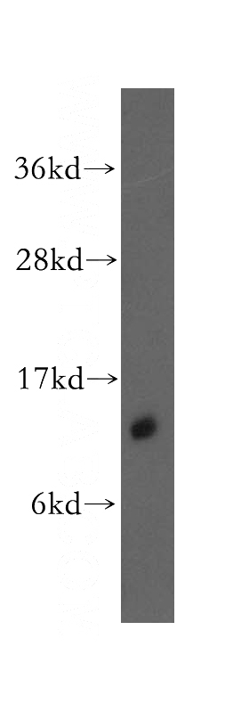 HeLa cells were subjected to SDS PAGE followed by western blot with Catalog No:109778(DDT antibody) at dilution of 1:500