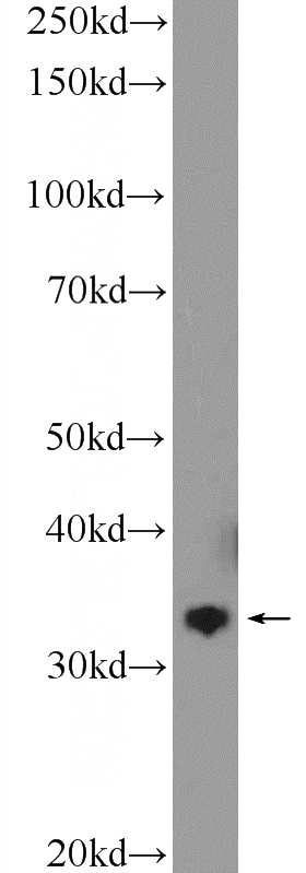 HEK-293 cells were subjected to SDS PAGE followed by western blot with Catalog No:110735(FN3KRP Antibody) at dilution of 1:600