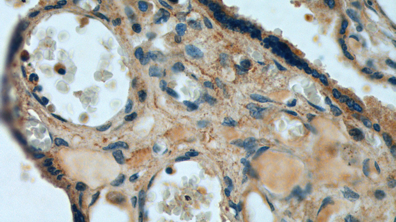 Immunohistochemistry of paraffin-embedded human placenta tissue slide using Catalog No:110655(FBN2-Specific Antibody) at dilution of 1:100 (under 40x lens).