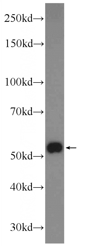 mouse brain tissue were subjected to SDS PAGE followed by western blot with Catalog No:117171(ZNF394 Antibody) at dilution of 1:600