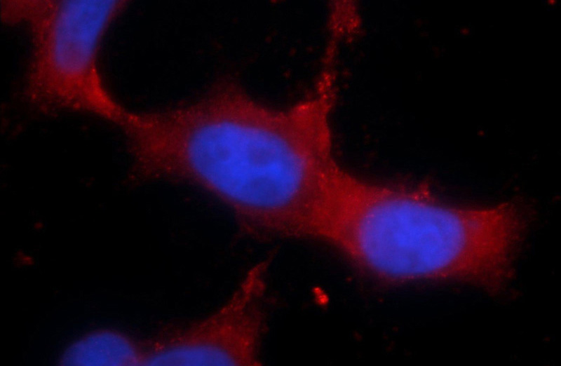 Immunofluorescent analysis of HEK-293 cells using Catalog No:116412(TRPM6 Antibody) at dilution of 1:25 and Rhodamine-Goat anti-Rabbit IgG