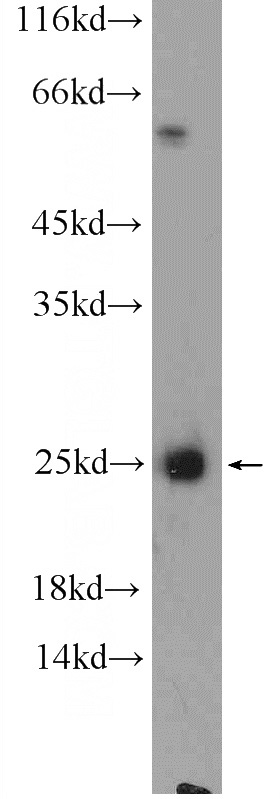 rat brain tissue were subjected to SDS PAGE followed by western blot with Catalog No:108831(CALN1 Antibody) at dilution of 1:300