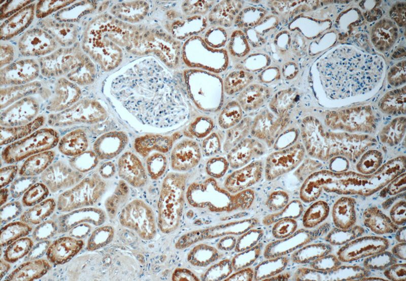 Immunohistochemistry of paraffin-embedded human kidney tissue slide using Catalog No:116100(TMEM154 Antibody) at dilution of 1:50 (under 10x lens)