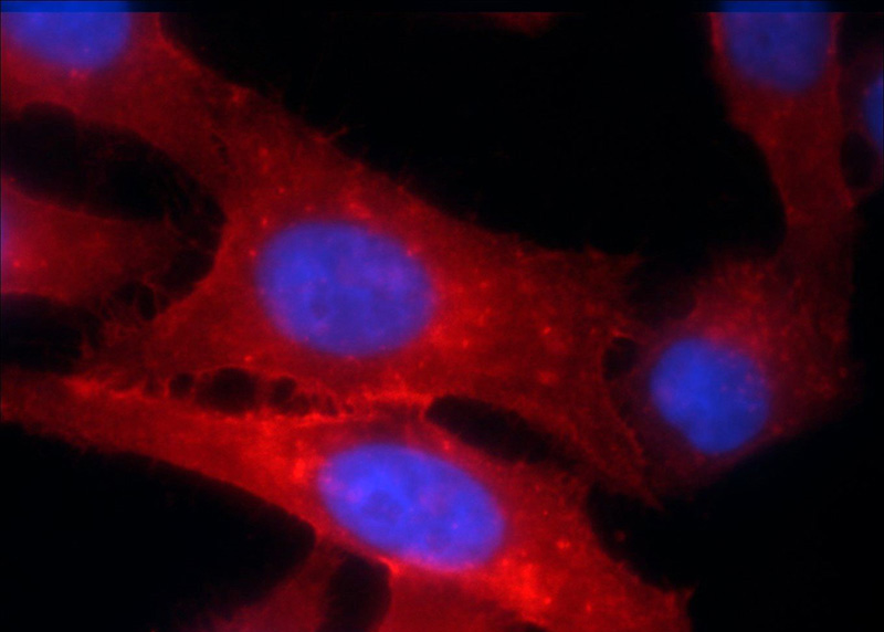 Immunofluorescent analysis of HepG2 cells using Catalog No:111414(HLA class I (HLA-A) Antibody) at dilution of 1:25 and Rhodamine-Goat anti-Rabbit IgG