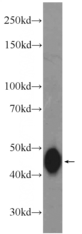 mouse colon tissue were subjected to SDS PAGE followed by western blot with Catalog No:111530(HOXA9 Antibody) at dilution of 1:600