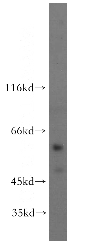 human lung tissue were subjected to SDS PAGE followed by western blot with Catalog No:115001(SCMH1 antibody) at dilution of 1:500